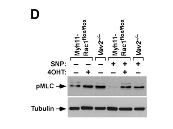 Western Blot using pMLC